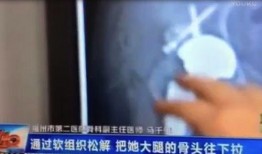 医生最新爆料新闻视频,揭秘医疗行业惊人真相！